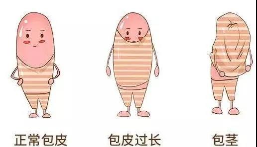 【保山安利醫(yī)院】家長速看！暑期包皮手術(shù)預約正當時！