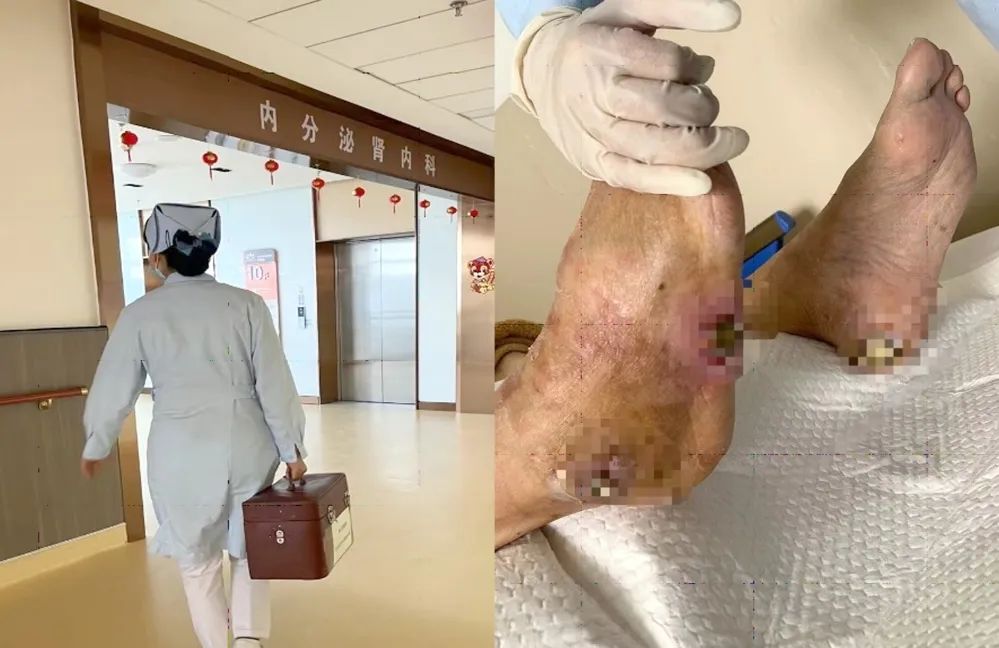 【保山安利醫(yī)院】傷口治療一站式，健康生活零距離！